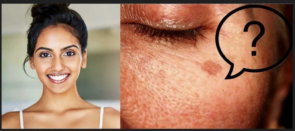 safe pigmentation treatment, pigmentation treatment without skin damage, dermatologist pigmentation treatment, melasma treatment India, laser pigmentation treatment, chemical peels for pigmentation